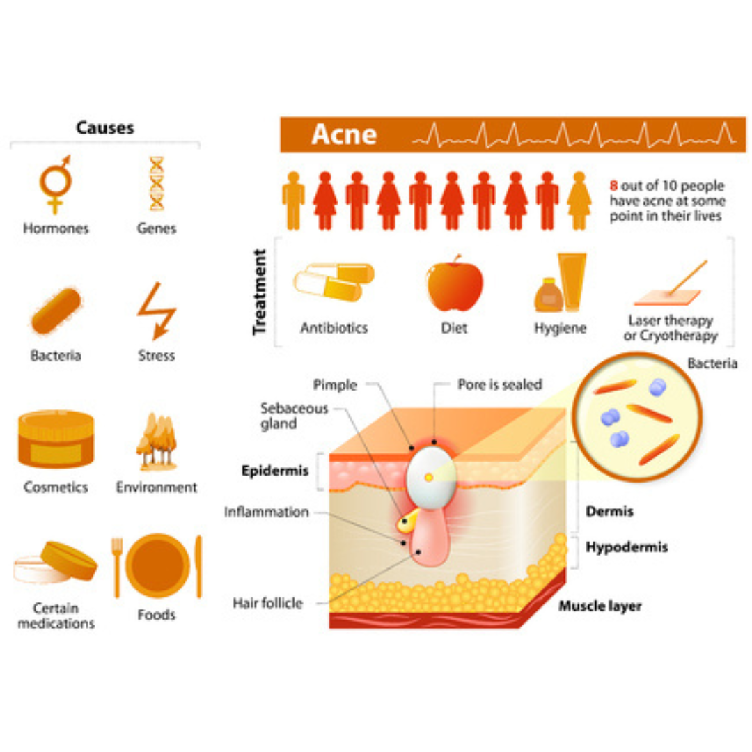 Acne/Rosacea Amino Acid